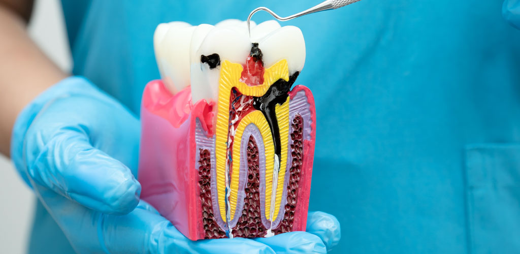 endodoncia-odonto-clinica-dental-doctor-javier-sanchez
